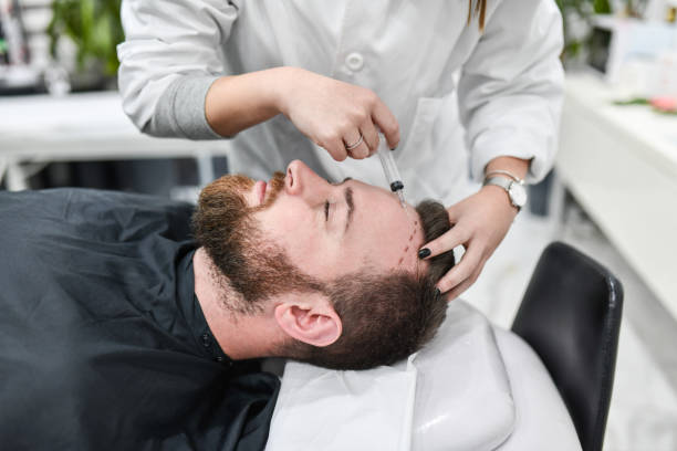 When should you consider hair transplantation?