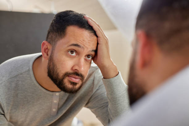 Hair loss causes and prevention