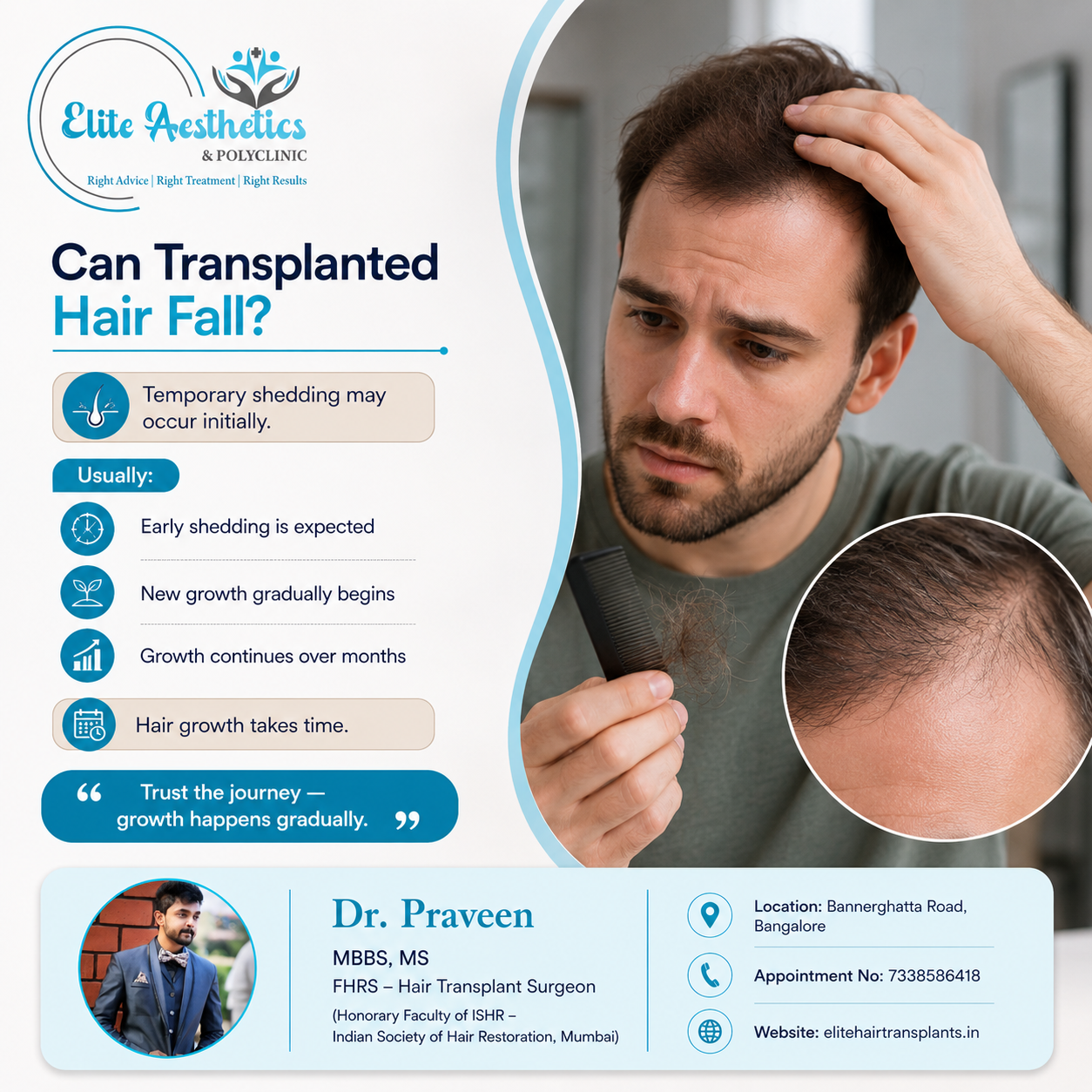 dr. praveen .( hair ) (17)