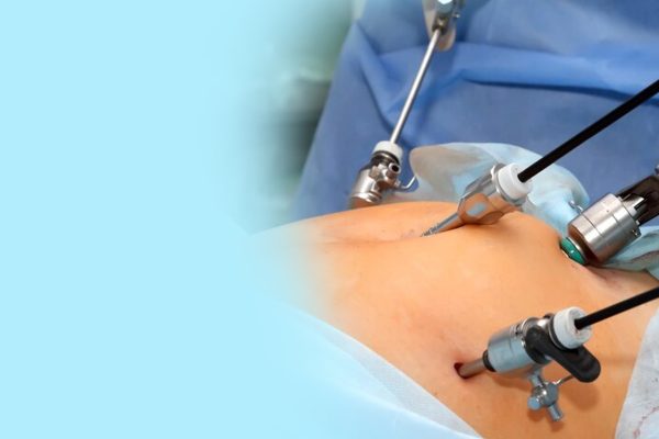 Laparoscopic-Surgery-Risks-Benefits-and-Recovery-img