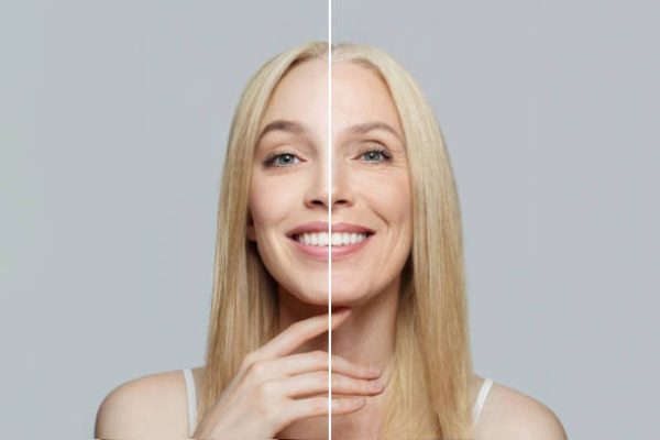 Blonde model woman with young clean skin and wrinkles. Aging and youth, aesthetic surgery, beauty treatment and cosmetology concept